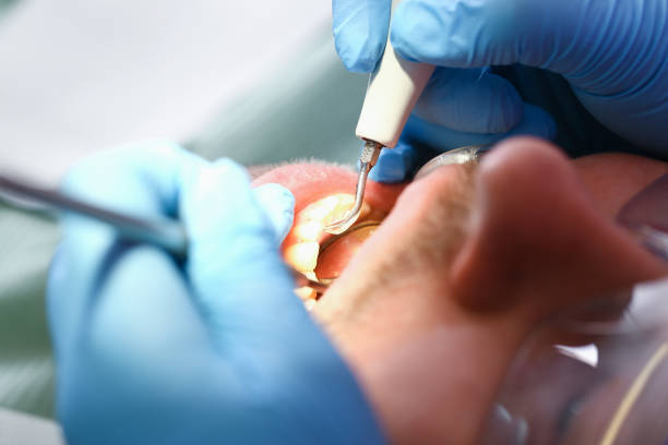 Best Pediatric Emergency Dentist in Weber City, VA