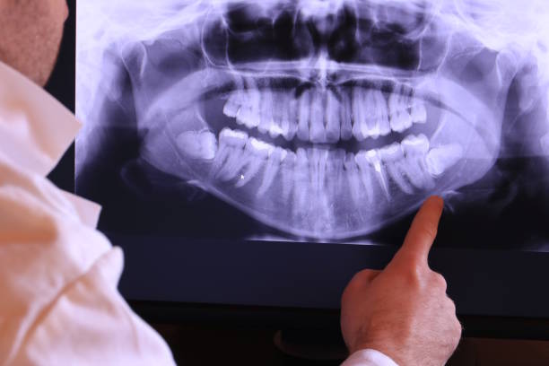Best Emergency Dentist for Knocked-Out Tooth in Weber City, VA