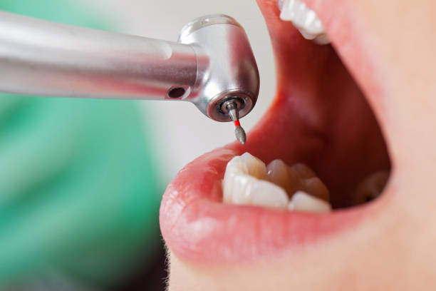 Best Emergency Dentist for Knocked-Out Tooth in Weber City, VA